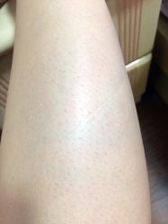 -韩莱科技美肤连锁