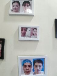 -天津健丽·去眼袋医疗美容机构