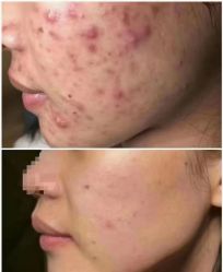 -痘庄科学祛痘国际连锁