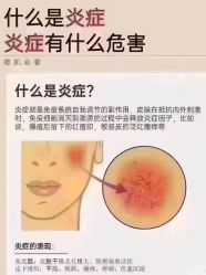 -瑶芳清颜草本祛痘