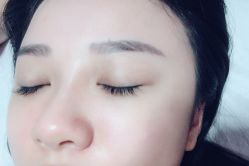 体验后-深圳美莱医疗美容医院