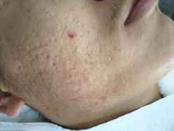 -痘博士北京·全国连锁祛痘机构