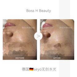 -Boss H Beauty美肌中心