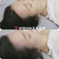 点击看大图 -西施无菌半永久纹绣眉眼影唇轻增发纹发际线