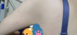 -北京美痣堂古方祛痣斑疣瘊