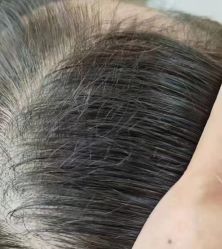 -希梵尔头皮抗衰·科技养发