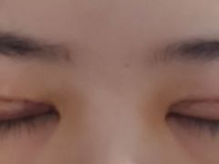 -苏州大学理想眼科医院