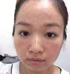 -E.beauty驻颜·痘敏肌调理中心