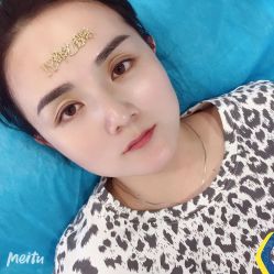 -郡艺医疗美容·微整·眼鼻吸脂