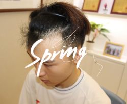 -大麦微针植发全国连锁