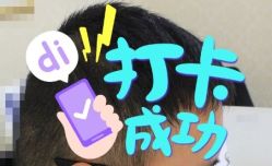 -大麦微针植发全国连锁