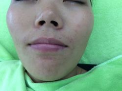 -苗医生草本科技祛痘