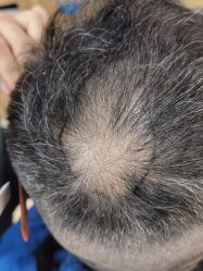 -雍禾植发全国连锁