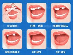 -柏乐口腔医院·舒适化无痛种植牙中心(东盟商务区院)