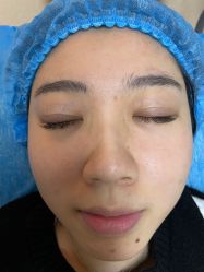 -圣嘉新医疗美容医院