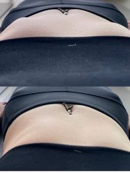 -A+瑜伽·普拉提