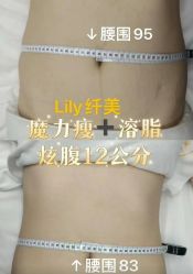 -Lily纤美·科技减脂中心
