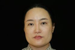 -广东韩妃整形外科医院