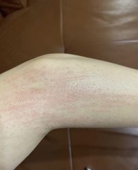 -成都西区医院整形美容
