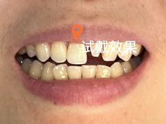 -四川大学华西口腔医院(华西院区)