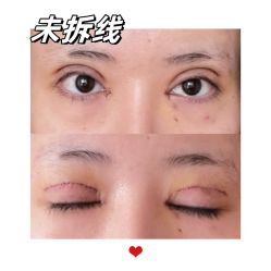 -素美医疗美容·西南眼鼻整形·修复基地