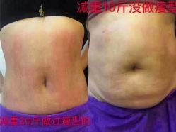-香薇妮丝女子减肥院