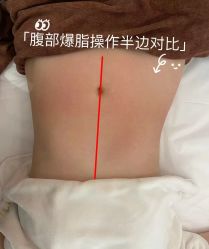 -Lily纤美·科技减脂中心