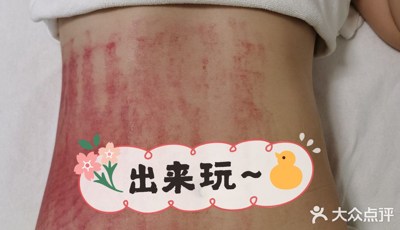瘦成一道闪电，亮瞎你们的眼💖💖