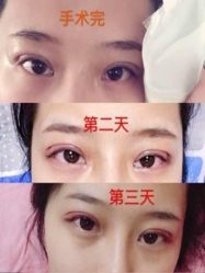 -美莱医学美容医院
