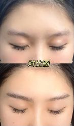 点击看大图 -OnFaer.纹眉半永久无创洗眉