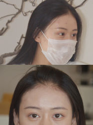 -清疣美疣·痣·斑净肤中心
