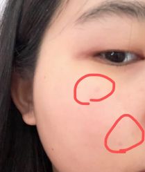 体验后-成都西区医院整形美容