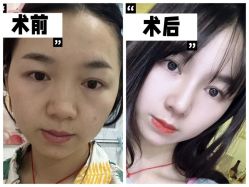 -素美医疗美容·西南眼鼻整形·修复基地