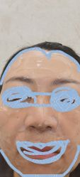 体验后-Yestar重庆艺星医疗美容医院