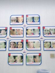 -悟空祛痘·诺奖技术专业店