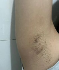 体验后-石家庄苏亚美联臣医疗美容医院