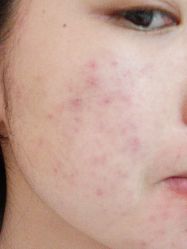 -西安现代妇产医院医疗美容