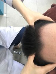 -黑奥秘脱发白发中心