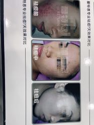 -蕾特恩专业祛痘·皮肤管理