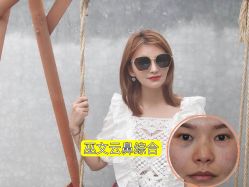 -北京米扬丽格医疗美容·联合丽格鼻整形中心