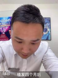 -熙朵美学植发连锁