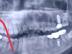 -牙博士口腔品牌连锁(杨浦店)