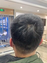 -雍禾植发