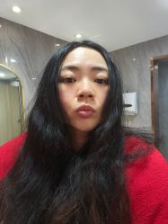 点击看大图 体验后-南京康美美容医院·旗舰店