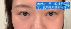 -八大处整形
