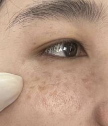 -Cream88颜皮肤管理中心