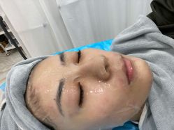 体验后-北京英煌医疗美容
