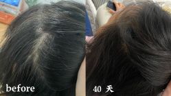 -舒欣头疗·俏丝谧语 白发脱发专业护理 