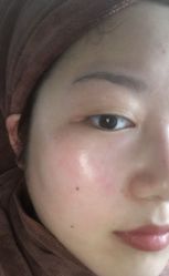 体验前-杭州整形医院·国际部