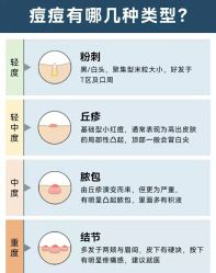 -蕾特恩·专业祛痘国际连锁
